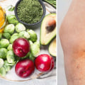 What Diseases Are Linked to Vitamin Deficiencies?