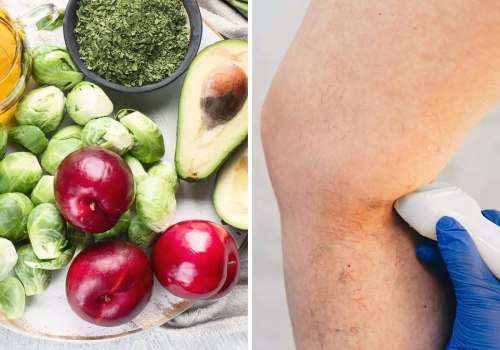 What Diseases Are Linked to Vitamin Deficiencies?