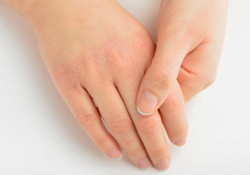 Vitamin Deficiency Symptoms: How to Recognize and Treat Them